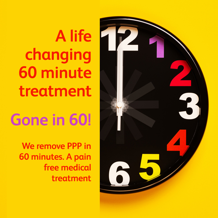 Pearly Penile Papules removed in 60 minutes