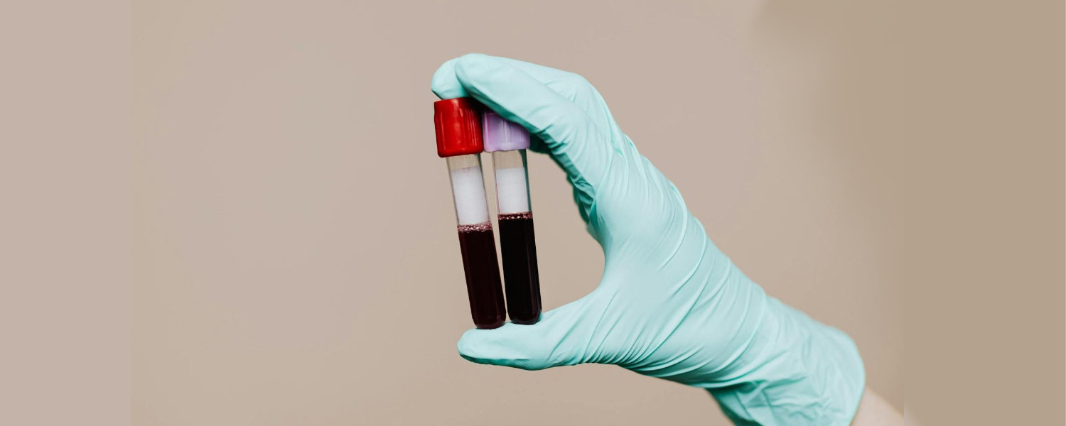 How Are Pearly Penile Papules Diagnosed?