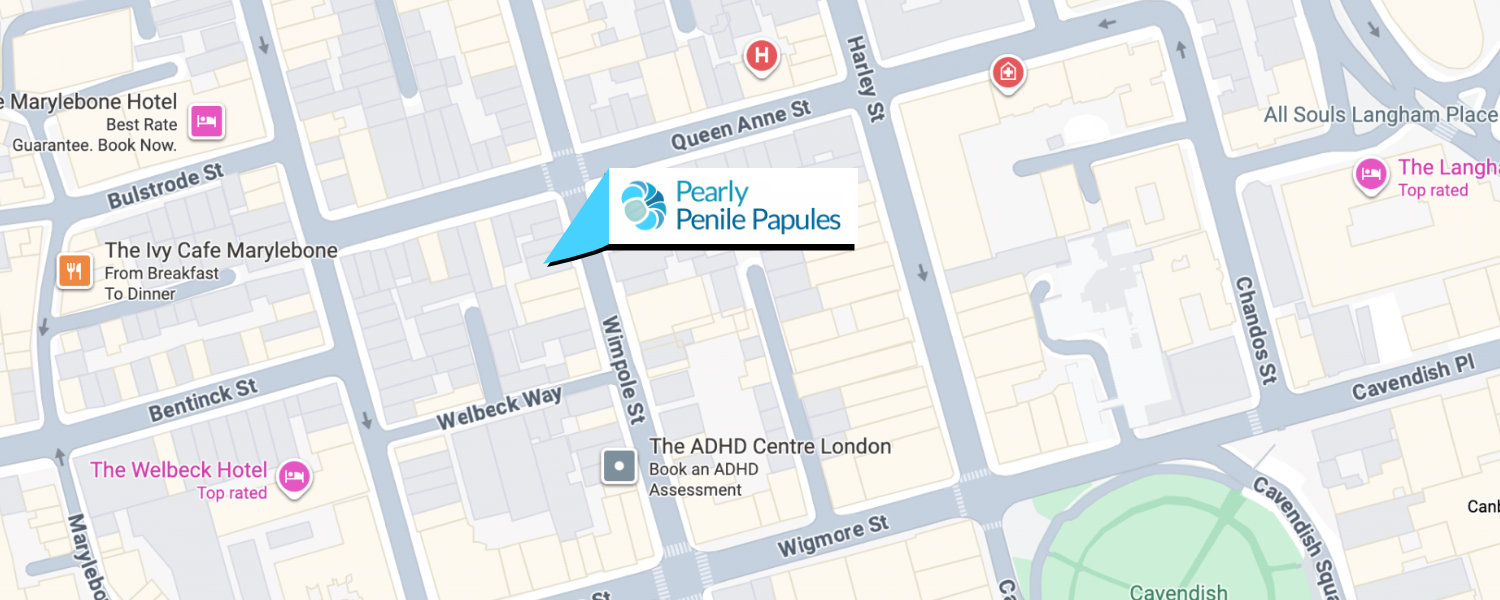 PPP Removal Wimpole Street London Clinic